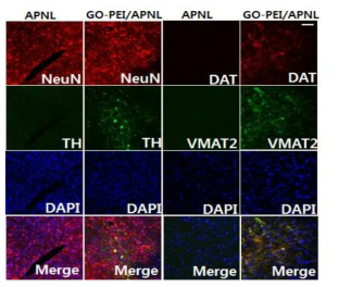 6OHDA를 처리하여 도파민 신경을 사멸시킨 마우스 뇌에 GO-PEI-mRNA 처리 후 도파민신경마커(TH, VMAT2)로 면역염색