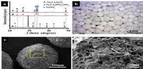 Microsphere의 XRD 및 SEM 이미지