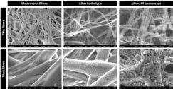 전기방사 멤브레인의 SEM 미세조직 이미지