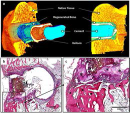 토끼 대퇴부 이식 후 μ-CT, 조직염색