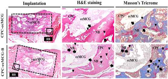 CPC-ccMCG, CPC-ccMCG-B의 이식 4주 후 H&E 및 M-T 염색 분석 결과