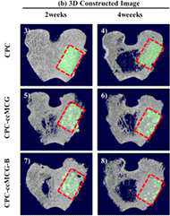 3D M-CT 분석