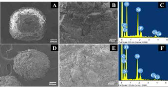 Polydopamine 도핑 Bioglass의 SEM 및 EDS 분석