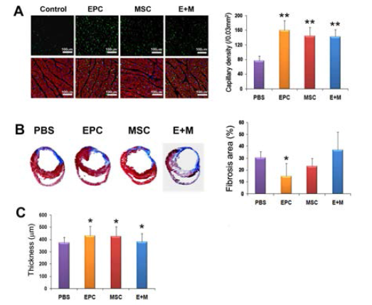 생체내 심장 손상 기 능 평가. 모세혈관 생성능력 (A), 심장의 fibrosis 결과 (B), 심장의 두께(C)