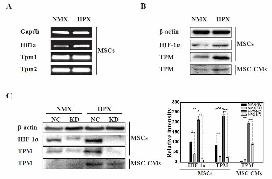 HIF- 1α와 Tropomysin의 연관성 확인