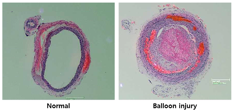 정상혈관과 손상혈관의 비교분석