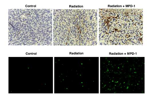 EMC-DEVD-DOX와 방사선치료 병용 시 PAN02 allograft 모델에서의 caspase3의 발현 정도와 apoptosis변화