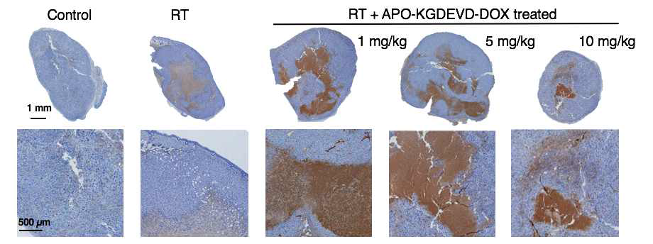 APO-DEVD-DOX와 방사선치료 병용 시 MDA-MB-231 xenograft 모델에서의 caspase3의 발현 정도와 apoptosis변화