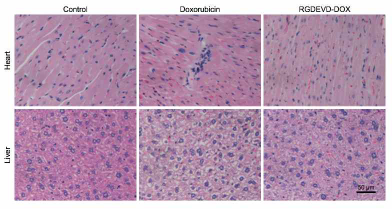 Free doxorubicin, RGDEVD-DOX 투여 시 조직학적 독성 평가 결과