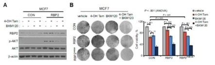 RBP2 하위 기전 저해와 tamoxifen 복합 치료 효과 (JNCI, 2018)