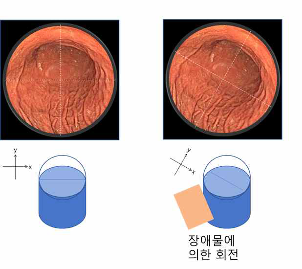 캡슐내시경은 외부의 장애물 등에 부딪혔을 때 주축방향으로 쉽게 회전 발생