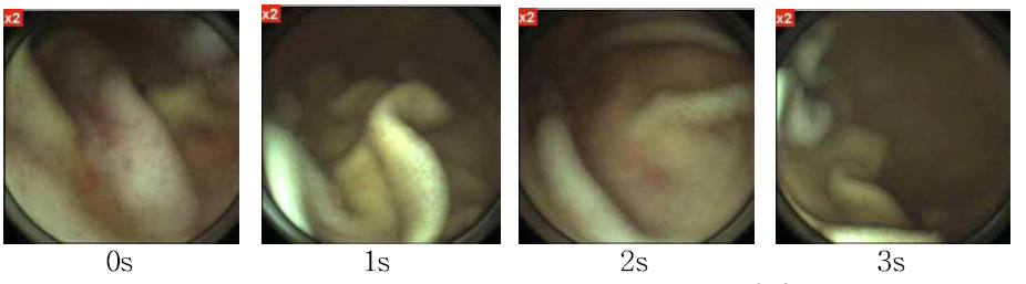캡슐내시경의 위 내벽 촬영 영상