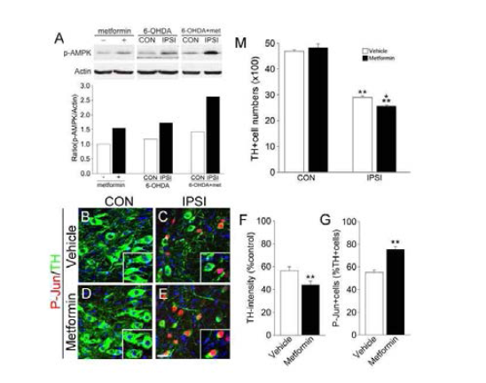 도파민 신경세포 사멸기전에 AMPK activator의 효과 검증