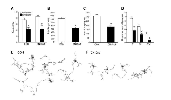 Drp1활성저해에 의한 축색돌기 길이 및 곁가지의 수 변화