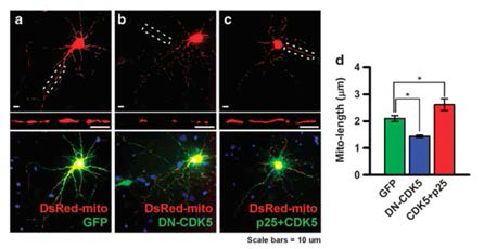 CDK5에 의한 Drp1인산화와 그에 따른 미토콘드리아 형태 변화