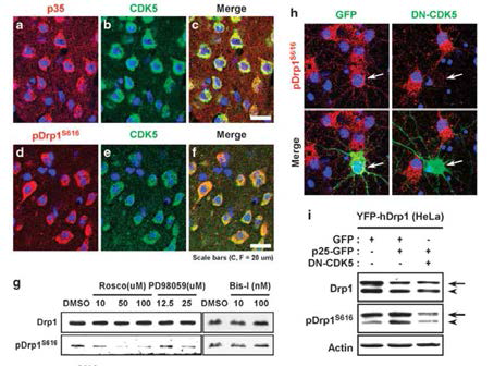 CDK5가 관여된 Drp1s616인산화