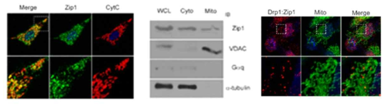 Zip1의 세포내 위치 확인 및 Drp1과 결합장소 분석