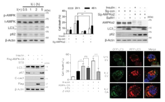 인슐린 결핍 성체해마신경줄기세포에서 AMPK활성과 자가포식 세포사멸 조절 관찰