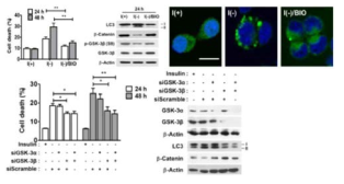 GSK-3β 활성억제에 따른 오토파지 세포사멸 감소 관찰