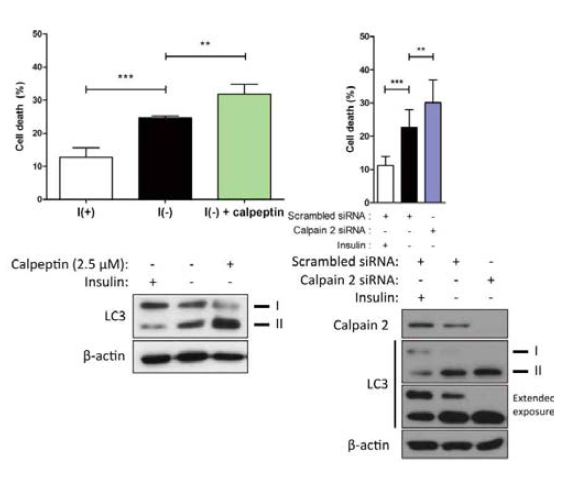 인슐린이 결핍된 성체해마줄기세포에서 Calpain2 비활성화에 의한 오토파지 세포사멸 증가 관찰