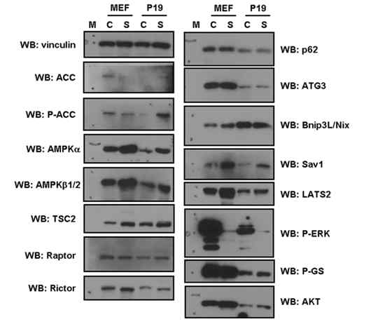 줄기세포와 섬유아세포 성장과정의 에너지 항상성 조절 신호전달계 및 자가포식계 단백질 발현, 활성 변화분석