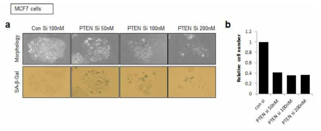 PTEN 유전자 발현 억제의 농도 의존적인 암세포 노화 현상을 인간 유방암세포 MCF7에서 관찰 (a) 세포노화특이적 베타 갈락토시다아제 활성도 관찰 (b) 세포 증식율 관찰