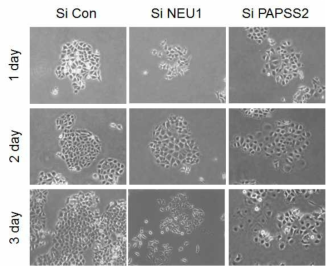 유방암세포(MCF7)에서 NEU1 siRNA 처리 후 3일 동안 세포모양 관찰 PAPSS2는 양성 대조군으로 사용함