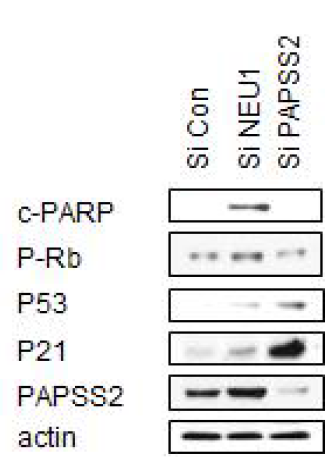 NEU1 siRNA 처리한 유방암세포(MCF7)에 서 세포사멸 또는 노화 관련 인자를 웨스턴블랏으로 확인한 결과 세포사멸이 NEU1 유전자에 의한 주요한 작용기전임이 확인됨