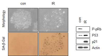 방사선 조사에 의한 유방암(MCF7)세포의 노화유도 확인을 SA-β-Gal assay와 웨스턴블랏팅으로 확인