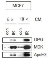 유방암 MCF7 세포에서 방사선 조사에 의해 노화된 암세포의 분비체 중 OPG, MDK, ApoE3증가를 웨스턴블랏팅으로 관찰