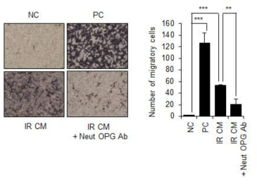 OPG 중화항체에 의해 노화 암세포 분비체를 포함하는 CM 처리시 증가했던 노화 암세포 분비체의 이동성 효과 억제