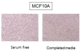 혈청을 포함한 완전배지에 의해 정상유선세포(MCF10A)에서 침윤성(invasion activity)에 영향 없음을 확인