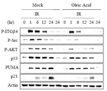 세포막의 유동성을 증가시키는 Oleic acid를 A549 세포에 처리한 후 방사선 유도 ITGB4 및 하위단백질의 인산화의 변화를 웨스턴 블롯으로 확인한 결과