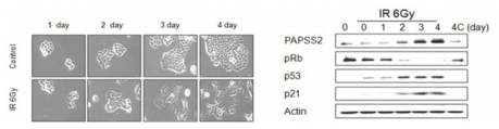 (특허출원 1의 내용) 유방암 세포주 MCF7 (A) 과 폐암 세포주 H460 (B) 에 방사선 6Gy 조사 한 후 세포노화 형태 변화 관찰 (좌측) 및 세포노화 지표의 변화를 웨스턴 블랏팅으로 관찰 (우측)