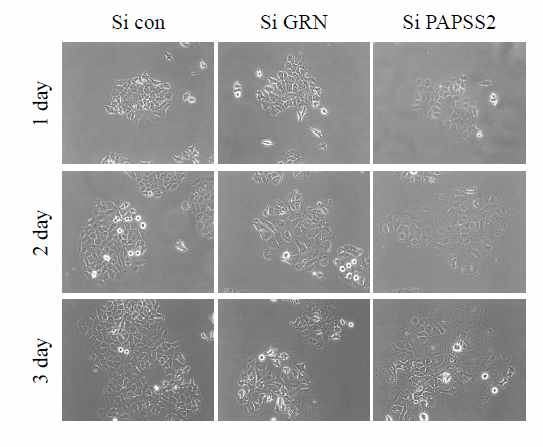 유방암세포(MCF7)에 GRN siRNA 처리하고 3일 동안 세포모양을 관찰함 (노화표현형의 양성대조군으로 PAPSS2 siRNA 처리함)