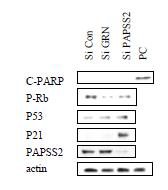 GRN siRNA 를 처리한 MCF-7 세포에서 세포하멸 또는 노화 관련 마커를 웨스턴 블랏으로 확인함