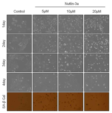 인간 유방암 세포주(MCF-7)에 MDM2 활성 저해제인 Nutlin-3a 의 다양한 농도 처리 후 세포의 형태변화와 노화특이적 베타갈락토시데이즈 활성화를 통해 노화 관찰