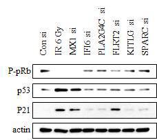 방사선 조사 후 노화된 혈관내피세포에서 발현이 증가되는 유전자 발현을 억제시킨 후 p53과 p21의 단백질 발현을 웨스턴 블롯으로 확인한 결과