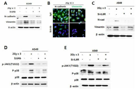 방사선 반응 분비인자 IL6에 의한 E3 ligase FBXL14의 발현감소에 따른 Twist 단백질의 안정화