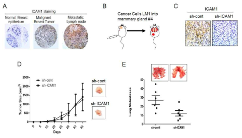 ICAM-1에 의한 유방암세포의 in vivo 전이능 획득