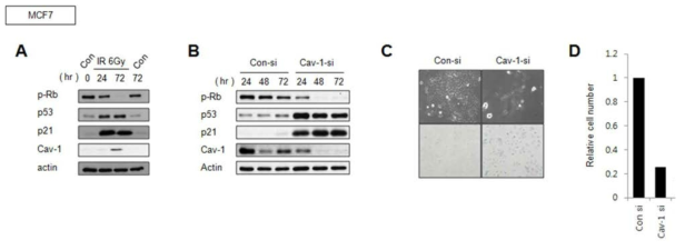 방사선 유도 세포노화반응시 MCF7 세포주의 Caveolin-1 단백질의 발현양이 증가함을 입증한 실험 (A) 및 Caveolin 1 유전자 발현의 억제에 의한 세포노화가 유도됨을 증명 (B-D)