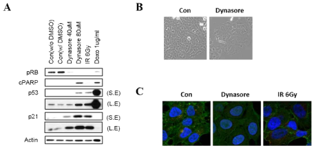 막수용체의 엔도사이토시스를 저해하는 Dynasore 처리에 의해 세포 노화 반응이 나타남을 웨스턴 블롯 (A) 과 노화특이적 베타갈락토시다아제 활성화(B) 측정을 통해 관찰 (C) bFGF 염색을 통해 막수용체 FGFR1 의 엔도사이토시스 가 방사선 유도 노화과정에서 저해됨을 confocal 분석법으로 확인