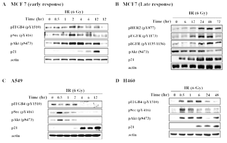 다양한 암세포주에 방사선에 의한 세포 노화 유도 후 단백질의 인산화 관찰 (A) 유방암 MCF7 세포주의 방사선 초기반응 (B) MCF7 세포주의 방사선 후기반응 (C) 폐암 A549 세포주의 방사선 초기반응 (D) 폐암 H460 세포주의 방사선 반응성(선행연구결과)