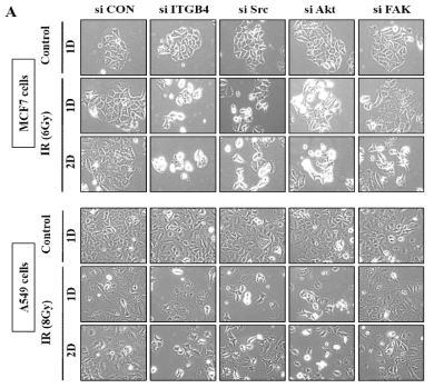 다양한 암세포주 (MCF7, A549) 에 지질단백질 관련 단백질 ITGB4, Src, AKT, FAK 의 결손을 유도한 후 방사선 유도 세포 노화 및 세포 자살의 세포형태학적 관찰