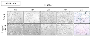 인간 폐암 세포주 A549 에 막단백질 ITGB4 의 억제제를 처리 한 후 방사선 유도 세포노화 반응성을 노화연관-베타갈락토시아다제 활성도로 측정한 결과
