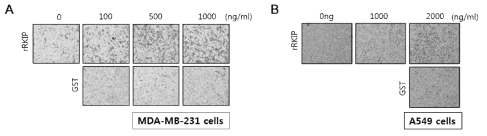 재조합 단백질 RKIP을 농도별로 처리한 인간 폐암 세포주 MDA-MB231과 A549 를 이용하여 암세포 침윤성을 분석한 결과