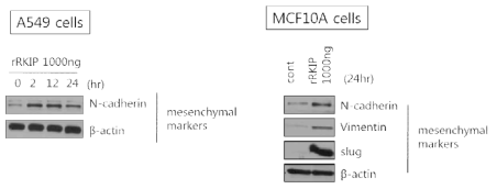 재조합 단백질 RKIP 의 암세포 (좌측) 및 정상세포 (우측) 의 EMT (Epithelial mesenchymal transition) 효능 분석