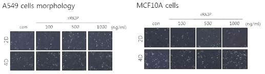 재조합 단백질 RKIP 은 암세포 (좌측) 및 정상세포 (우측) 의 세포노화의 형태로 변화시키지 않음을 증명한 결과
