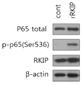 재조합 단백질 RKIP의 NF-kB 활성화 증진 효과를 관찰