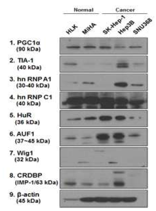 간암세포주에서의 후보 RNA의 단백질 발현